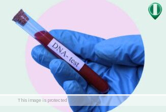 DNA Test Price in Nigeria